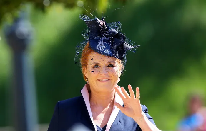 Duchess Fergie admits to Botox, but no longer likes the 'frozen look'