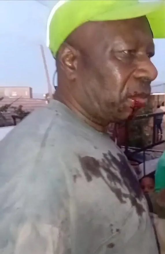Bonaphi Xakeka from Bloekombos said he suffered a bruised mouth and swelling to his head after his bakkie came under a barrage of stones.