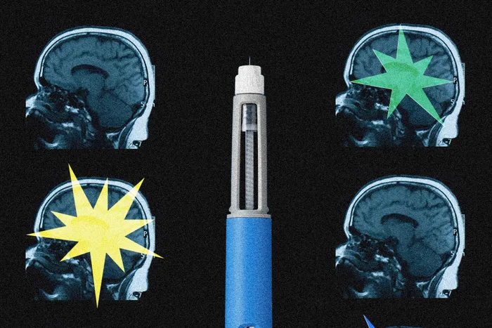 Within only a few months of taking the drugs, the brain connections in the salience network, which helps target attention, had multiplied.