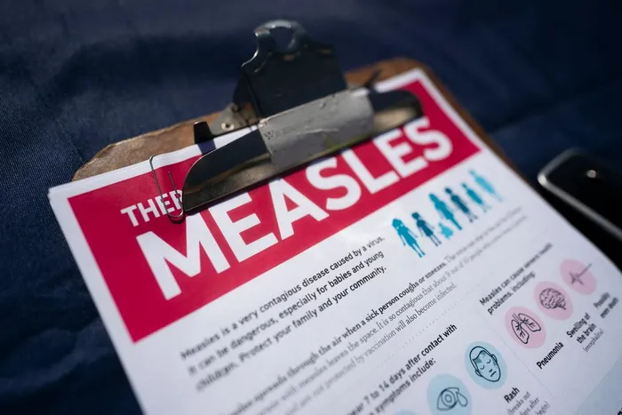 A measles outbreak in Bangladesh has killed more than 500 children, government data showed Saturday.
