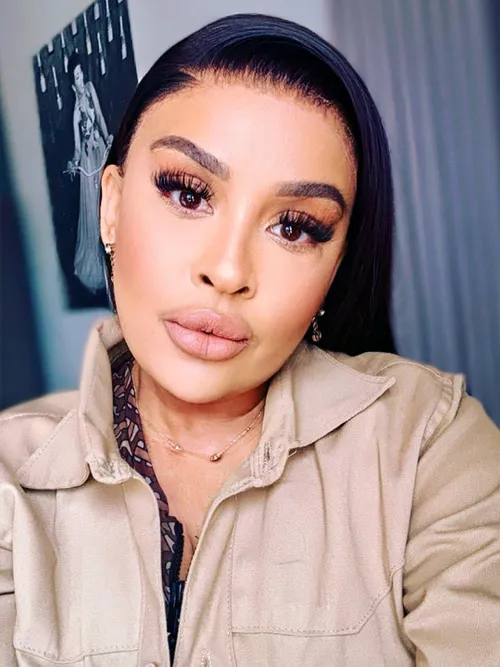 Nonku Williams shares recovery after “virtual lift” cosmetic procedure