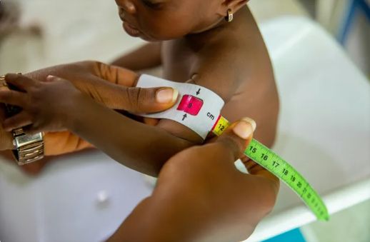 South Africa's strategy to end child stunting by 2030 faces critical challenges