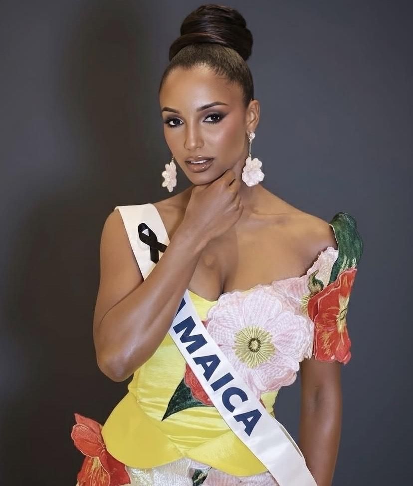 Miss Jamaica's fall at Miss Universe: fracture and brain haemorrhage details unveiled