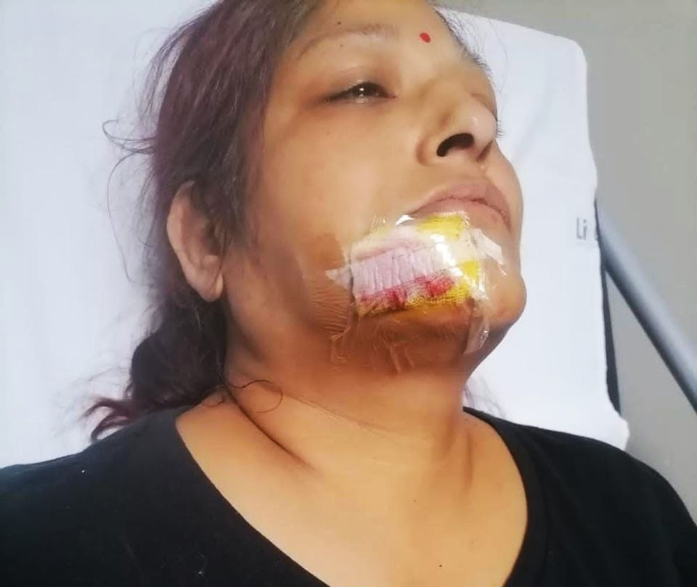 Shot in the face over water, Phoenix protester to join legal battle ...