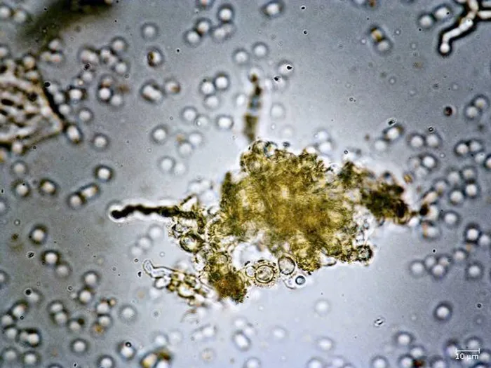 South Africa is poised to lead the global challenge to decode the enigmas of fungi with South Africa’s leading mycologist, Professor Cobus Visagie, to embark on a groundbreaking quest to decode this vital yet overlooked kingdom of life.

