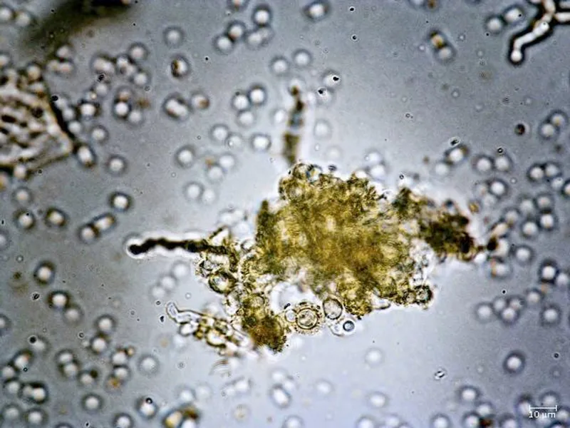 South Africa to spearhead global fungal research initiative