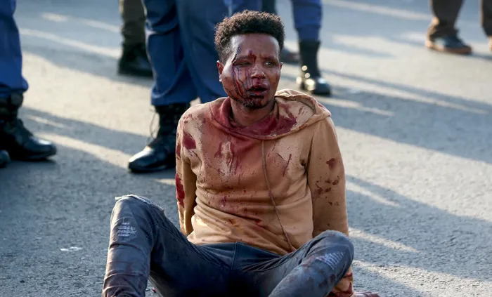 An injured man in the Durban CBD. 
