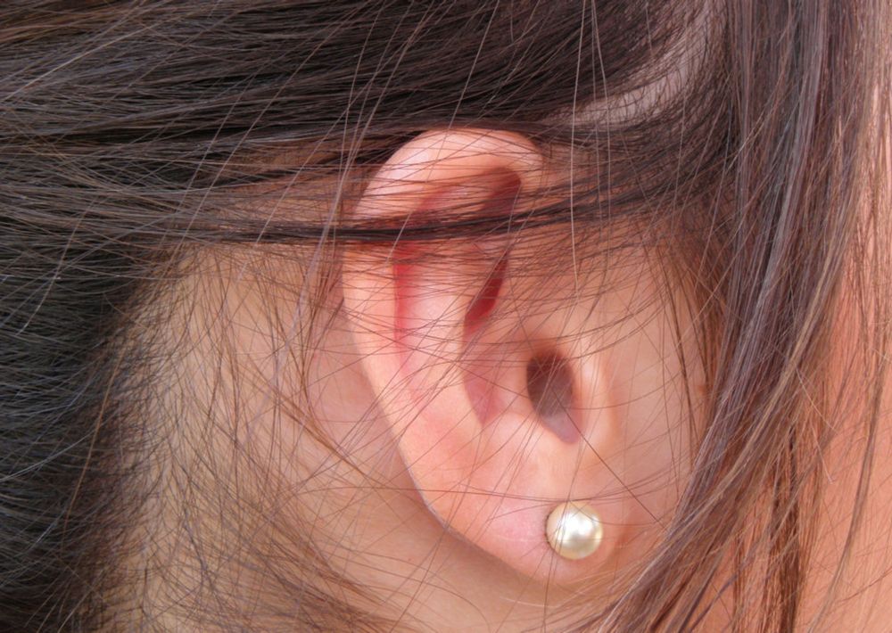 Research could change lives by reducing risk of hearing loss caused by ...