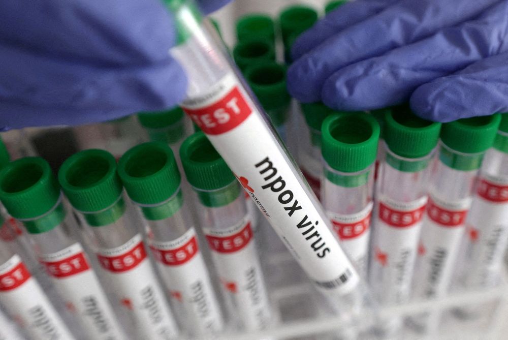 Mpox alert: Western Cape traces contacts after cases linked to two gatherings - IOL