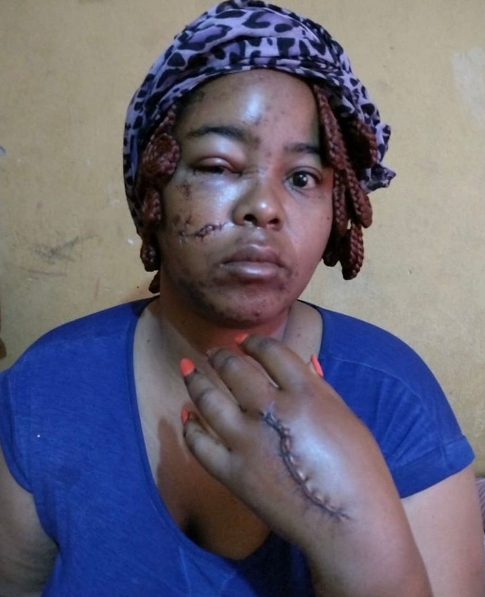 The State failed me, says badly injured GBV victim