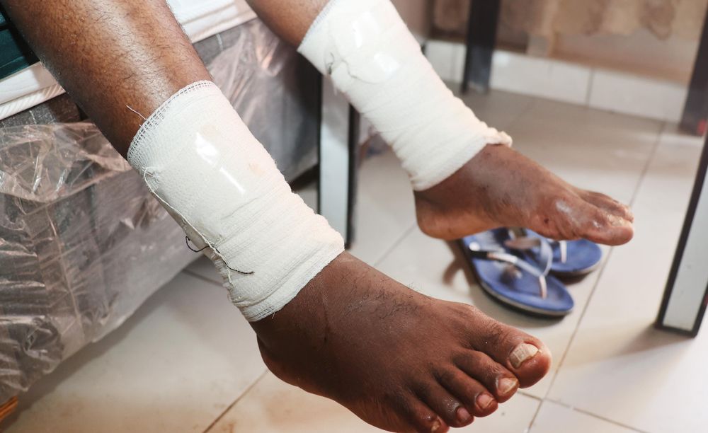 WATCH: a Phoenix man shared his harrowing experience after surviving a traumatic pit bull attack