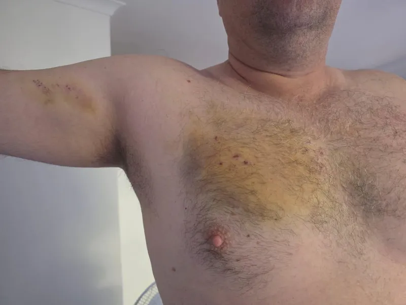 Somerset West resident suffers chest injury from stone-throwing incident