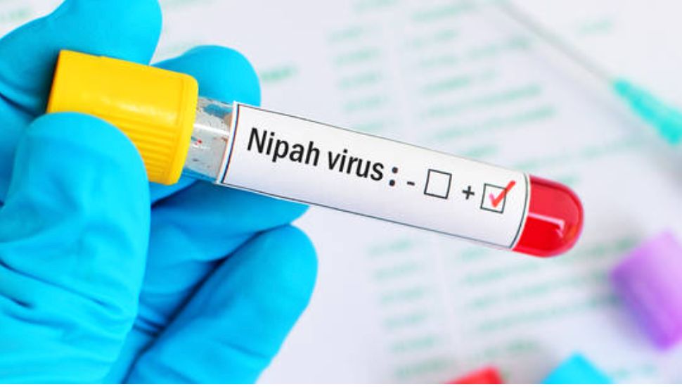 No need for panic over Nipah virus – Indian doctor