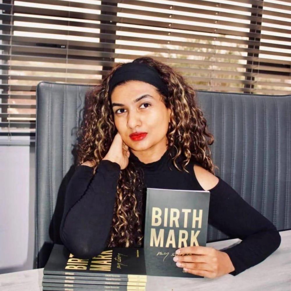 Living With a Birthmark: How Bullying Shaped My Mental Health and Self-Worth