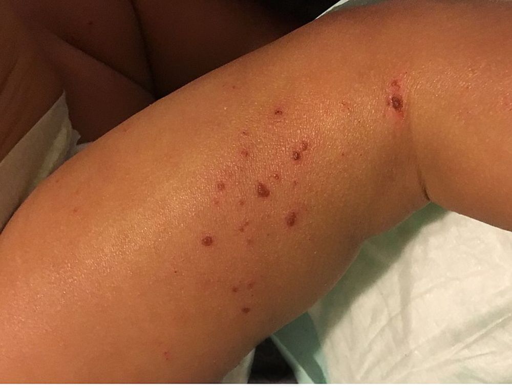 The great allergy myth