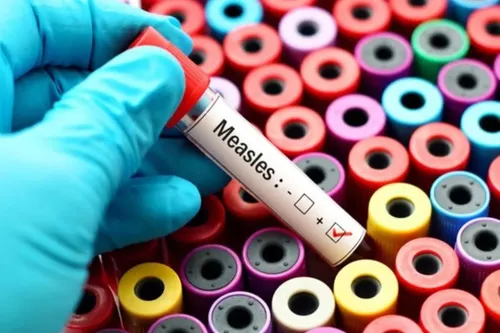 Measles resurgence in Cape Town: Protect your children now