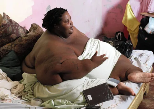 The woman who ate too much