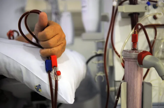 A patient receiving dialysis.
Picture: Mujahid Safodien 13 04 2012