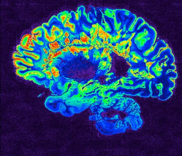 Covid on the brain - why some people take greater risks