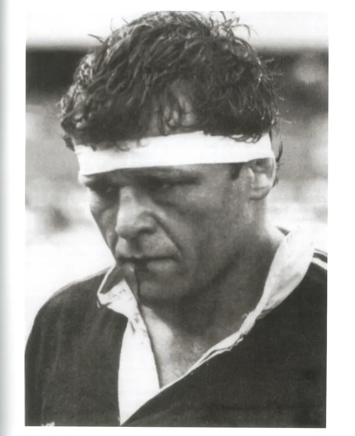 Andy Dalton broken jaw: Andy Dalton captained the Cavaliers but was sidelined after Northern Transvaal flank Burger Geldenhuys broke his jaw with a punch.