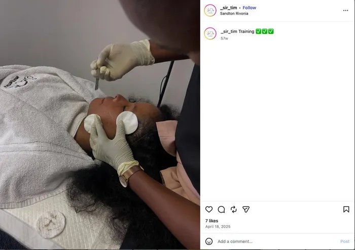 A client receives dermaplanning treatment, where the hair is removed using a blade