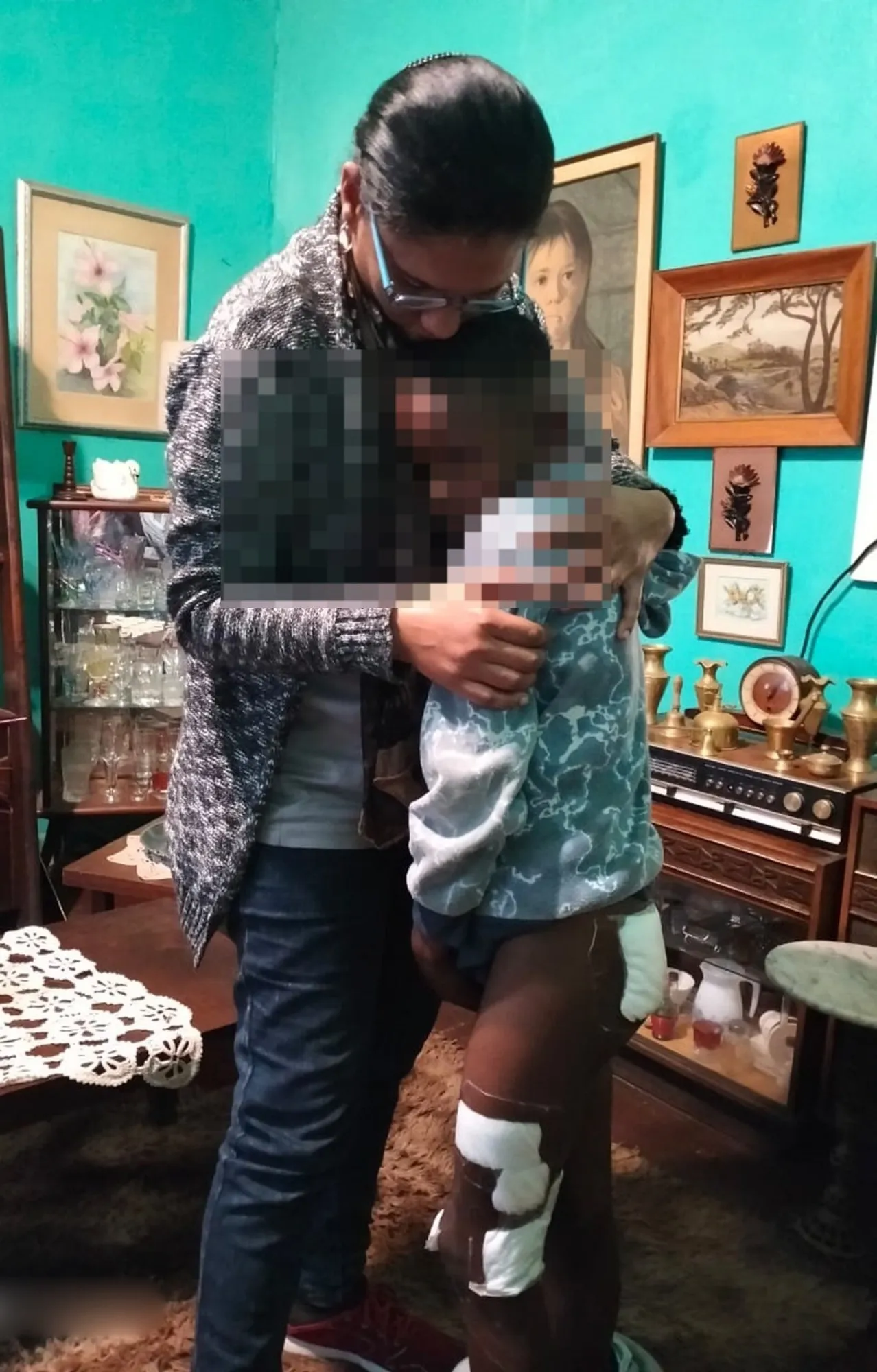 Boy, 10, mentally scarred after pit bull attack - Vimarsana News
