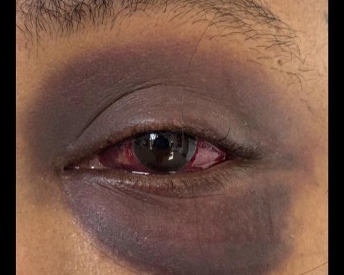 Police arrest Umlazi man for domestic violence after social media outcry