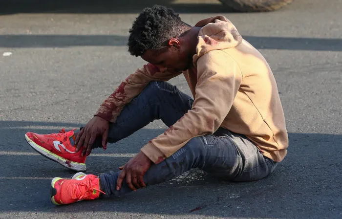 An injured man waits for medical assistance following violent unrest in the Durban CBD 