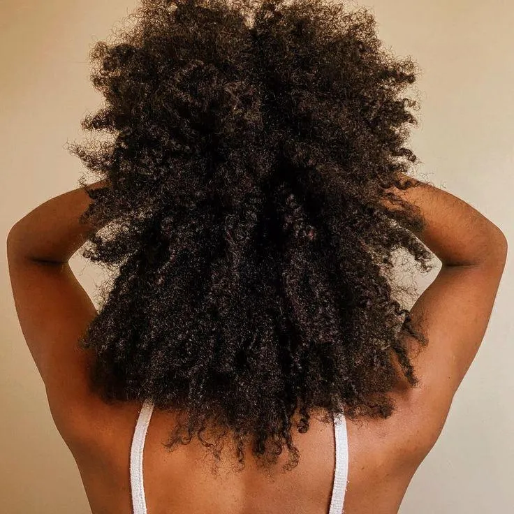 Breaking barriers: expert insights on Afro-textured hair and hair transplants