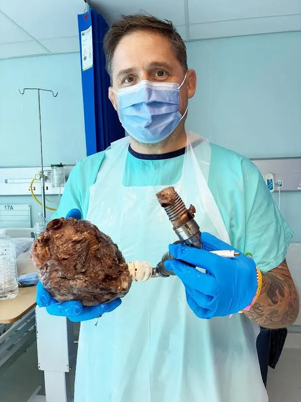 Rhys Thomas, 43, holds his damaged heart in his hands following his heart transplant at Netcare Christiaan Barnard Memorial Hospital in Cape Town.
