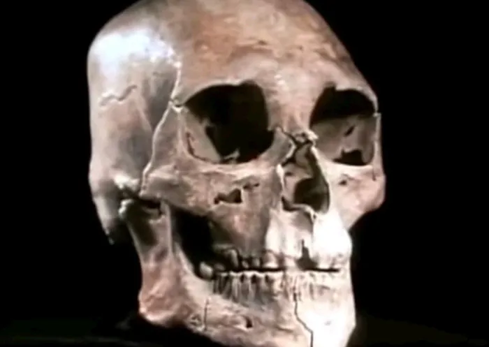 The origin of Kennewick Man is relevant to the future disposition of his bones.