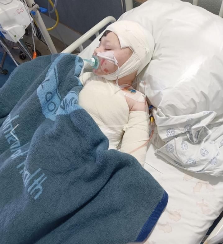 ‘R698,030 medical bill: Gauteng Health Department denies family liable for toddler burn victim's costs - IOL